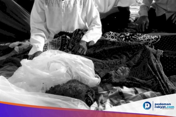 Seorang Nenek Berumur 100 Tahun Ditemukan Tinggal Tulang Belulang