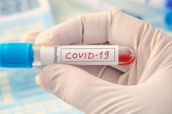 Ternyata Uji sampel Covid-19 di Indonesia Masih Jauh dari syarat WHO