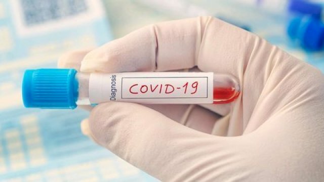 Ternyata Uji sampel Covid-19 di Indonesia Masih Jauh dari syarat WHO