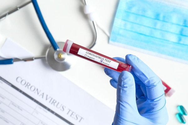 Ditangkap, Pejabat RS yang Buat Rapid Test Palsu di Makassar Kabur Masuk Desa di Maros