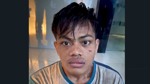 Reza alias Ucok, pelaku curat di Makassar yang terpaksa ditembak polisi karena melawan.