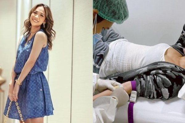 Terpapar Covid-19, Bunga Citra Lestari: Jangan Remehkan Virus Ini