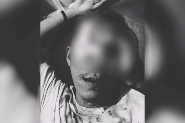 Perang Kelompok Kembali Terjadi di Makassar, Satu Warga Kena Busur Panah di Bagian Mata