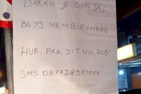 Miris, Demi Bertahan Hidup Disaat Pandemi Covid-19, Mantan Kernet Bus di Yogyakarta Rela Jual Ginjal