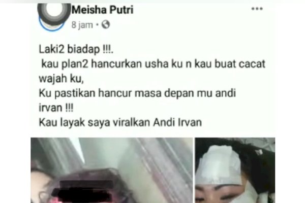 Pasutri Nikah Siri di Makassar Cekcok, Suami Tega Sayat Wajah Istri dengan Pisau