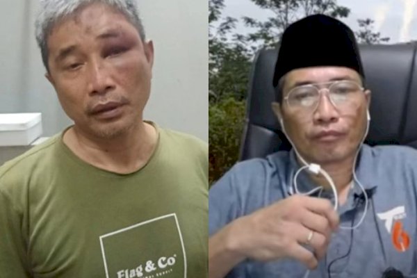 Ada 6 Calon Tersangka Penganiayaan Terhadap Muhammad Kece di Rutan