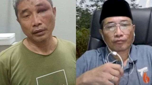 Ada 6 Calon Tersangka Penganiayaan Terhadap Muhammad Kece di Rutan