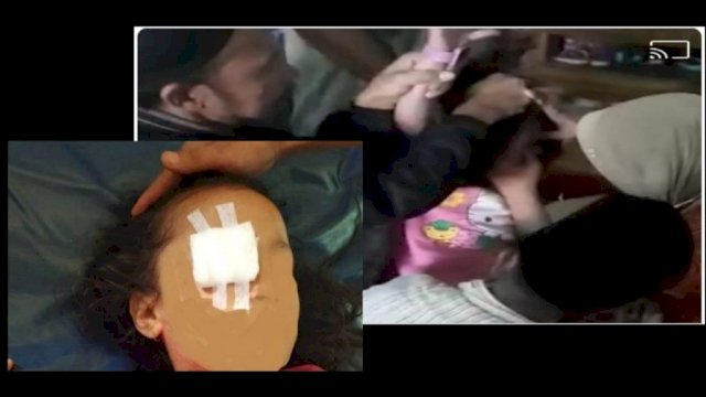 Babak Baru  Orang Tua Cungkil Mata Anak di Gowa, Makam Anaknya yang Jadi Korban Akan Dibongkar