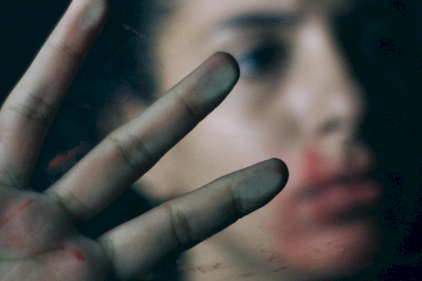 Ada Perempuan di Makassar yang Disiram Air Keras, Ini Kata Kompol Andi Ali Surya