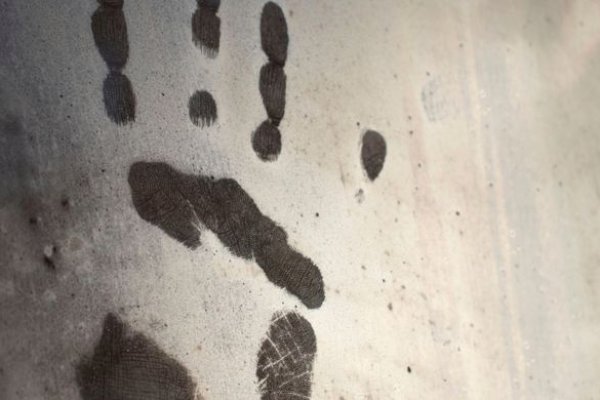 Melawan saat Motornya Hendak Dirampas, Pembegal Bacok Telapak Tangan Warga hingga Putus