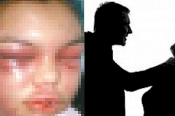 Cekcok hingga Hajar Istri Sampai Babak Belur, Pria Ini Ditangkap Polisi