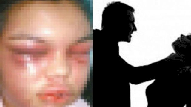 Ilustrasi Istri Dipukul Suami hingga Babak Belur.(F-Int)