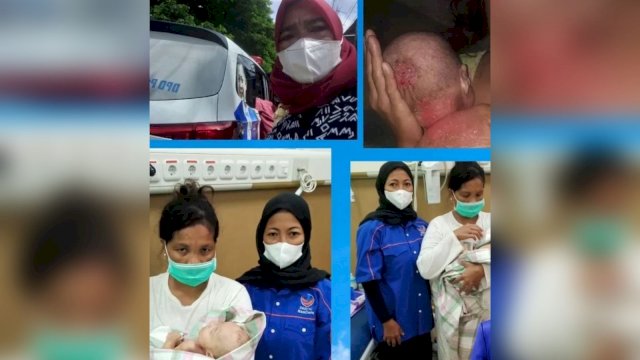 Viral Bayi Kulit Melepuh di Makassar dibantu Kader Nasdem.