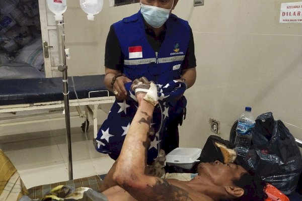 Kalah Main Higgs Domino Island-Diejek Saudara, Pria di Gowa Nekat Bakar Diri