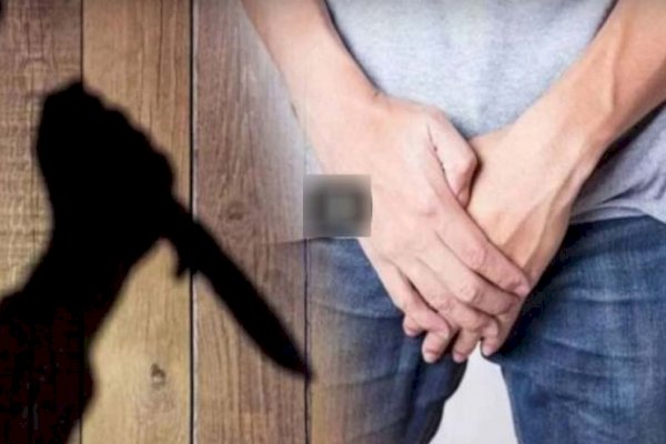 Ajak Berhubungan Intim, Pas Buka Celana Dalam Wanita Ini Malah Potong Alat Vital Suami