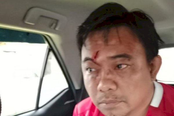 Politisi Golkar jadi Tersangka Pengeroyokan hingga Berdarah Ketua Umum KNPI