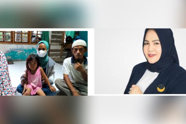 Ada Ortu Butuh Bantuan Pengobatan bagi Anaknya, Sahabat Putri Dakka di Palopo Cepat Datangi-Beri Biaya