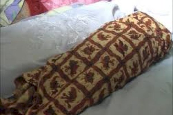 Diduga Hepatitis Akut, Anak Perempuan di Tulungagung Jatim Meninggal