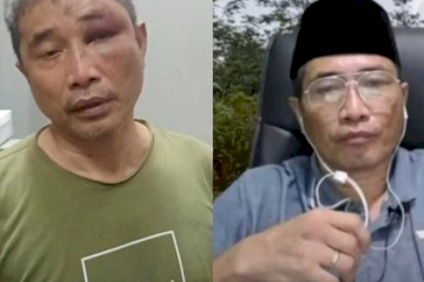 Kelakuan Napoleon Dibongkar Muhammad Kece, Dianiaya Bertubi-tubi hingga Tinja Dimasukin ke Mulut