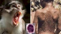 Waspada, Cacar Monyet di Eropa Meningkat 3 Kali dalam 2 Pekan