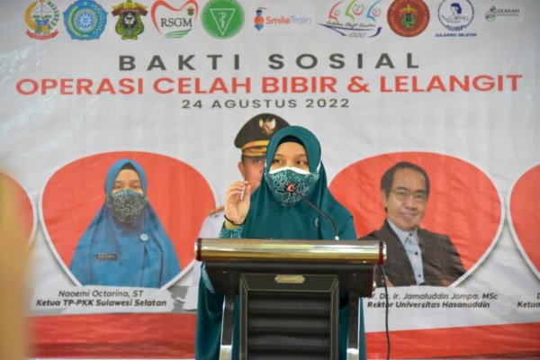 Gandeng Sejumlah Organisasi, PKK Sulsel Gelar Bakti Sosial Operasi Celah Bibir dan Lelangit