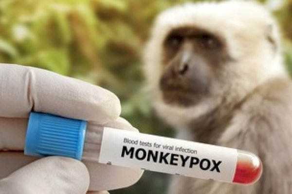 Menkes: Cacar Monyet di Indonesia Tipe tidak Fatal