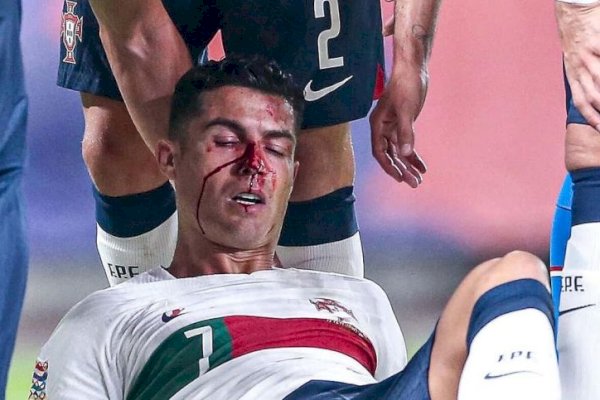 Portugal Kuasai Puncak Usai Pesta Gol, Cristiano Ronaldo Berdarah