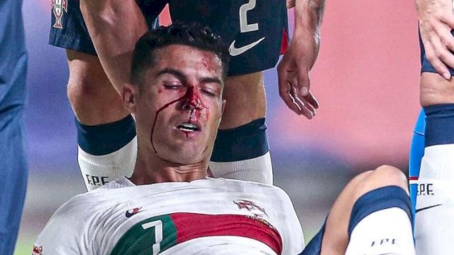 Portugal Kuasai Puncak Usai Pesta Gol, Cristiano Ronaldo Berdarah