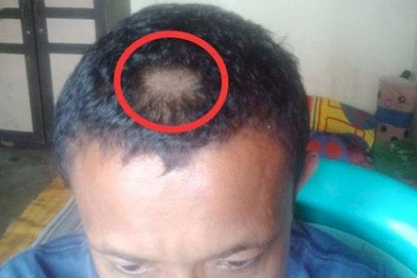 Orangtua Siswa Gunting Paksa Rambut Guru karena Tak Terima Rambut Anaknya Dicukur