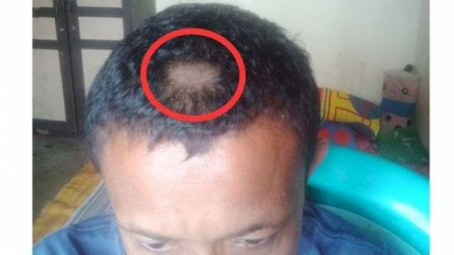 Orangtua Siswa Gunting Paksa Rambut Guru karena Tak Terima Rambut Anaknya Dicukur