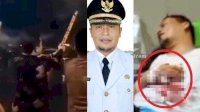 Insiden Kembang Api Meledak di Tangan Wabup Kaur Saat Tahun Baru, Ini Kondisinya