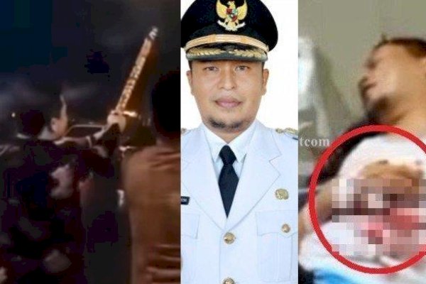 Insiden Kembang Api Meledak di Tangan Wabup Kaur Saat Tahun Baru, Ini Kondisinya