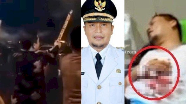 Insiden Kembang Api Meledak di Tangan Wabup Kaur Saat Tahun Baru, Ini Kondisinya