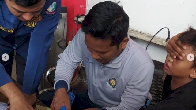 Tak Bisa Terlepas, Damkar Makassar Bantu Lepas Cincin Anak