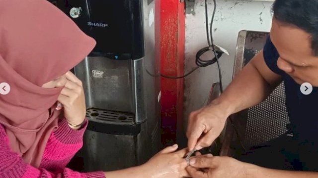 Damkar Makassar Bantu Warga Lepas Cincin di Jarinya