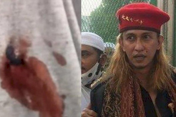 Penembakan Habib Bahar, Polisi: Bercak Darah di Sorban dan Luka di Perut