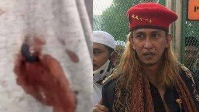 Penembakan Habib Bahar, Polisi: Bercak Darah di Sorban dan Luka di Perut