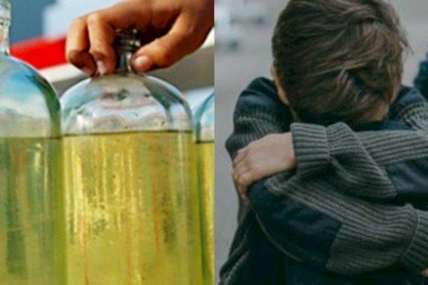 Bocah 12 Tahun di Purwakarta Kecanduan Aroma Bensin, Alami Gangguan Pernapasan dan Fungsi Saraf