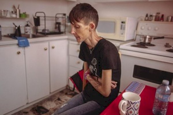 Derita Anoreksia, Wanita Ini Minta Disuntik Mati: Tiap Hari Bak Neraka!