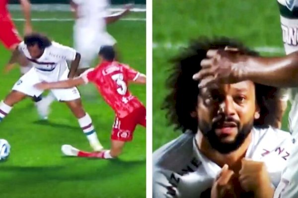 Ngeri! Eks Kapten Real Madrid Marcelo tak Sengaja Injak Kaki Bek Argentina hingga Patah