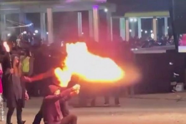 Ngeri! Jenggot Pesulap Limbad Terbakar Saat Aksi Sembur Api, Dilarikan ke Rumah Sakit