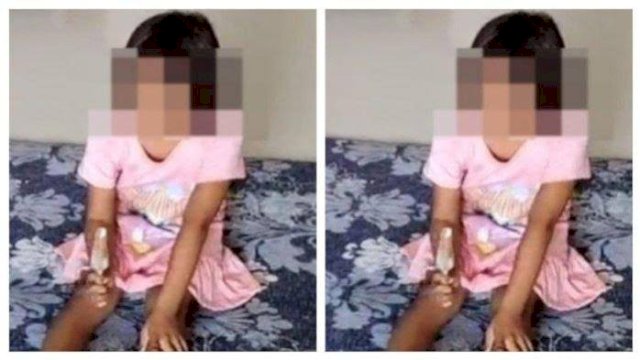 Miris! Mata Dicolok Tusukan Bakso Kakak Kelas, Siswi SD Gresik Buta Permanen, Ayah Korban: Trauma