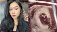 Kondisi Terkini Isyana Sarasvati Usai Keguguran, Unggah Foto USG: Sampai Berjumpa Lagi