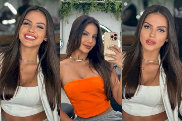 Tragis, Influencer Brasil Meninggal Pasca Jalani Operasi Sedot Lemak