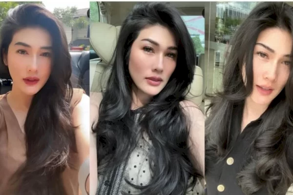 Selebgram Stevie Agnecya Meninggal Dunia