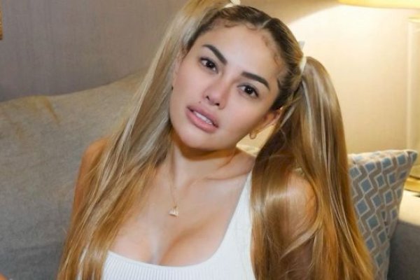 Nikita Mirzani Bongkar Chat dari Rizky Irmansyah Usai Ngaku Dianiaya: Aku Rindu