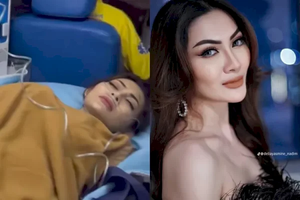 Nyaris Tewas, Artis Delia Yasmine Kecelakaan di Tol Jagorawi, Bahaya Nyata Ngantuk Saat Mengemudi