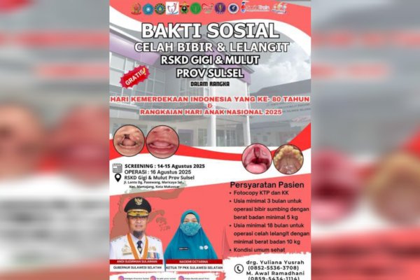 RSKD Gigi dan Mulut Sulsel Gelar Operasi Gratis Celah Bibir dan Lelangit