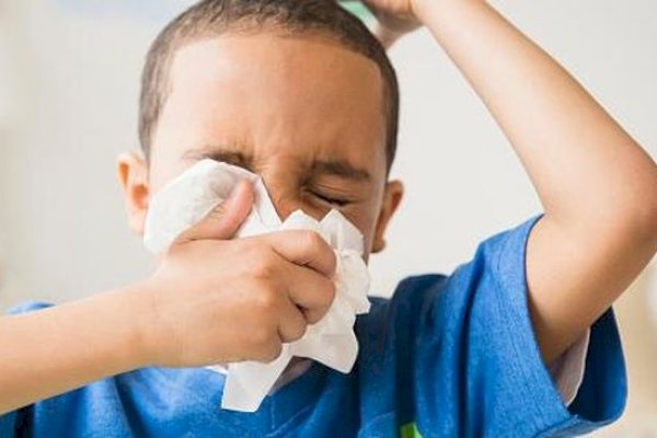Kemenkes Temukan 74 Kasus ‘Super Flu’ di RI, Ini Gejala yang Dikeluhkan Pasien