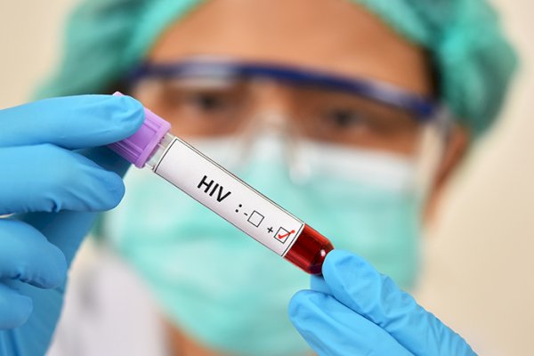 DPRD Makassar Inisiasi Ranperda HIV/AIDS, Pencegahan Jadi Prioritas